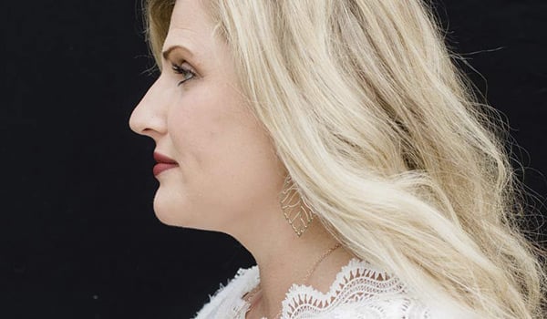 Face/Neck Lift & Contour after side view