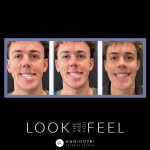 Photo of Jaw Surgery